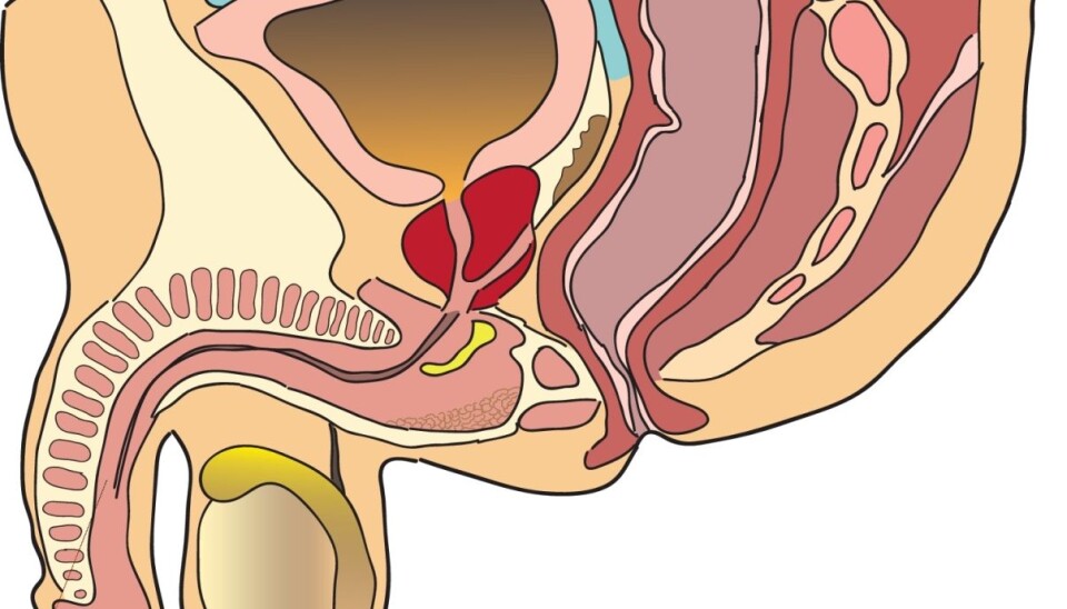 Cancer in the testicles is the most common form of cancer in men between 15 and 40 years of age. (Ill.: Colourbox)