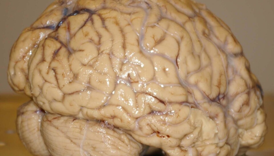 High performers have an astonishing integration of brain functioning (Photo: Bjørnar Kjensli)