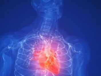 Cannabis use causes 40 heart attacks annually in Norway (Photo: iStockphoto) Cannabis use causes 40 heart attacks annually in Norway (Photo: iStockphoto)