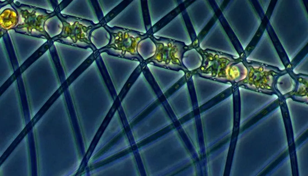 The planktonic alga Chaetoceros atlanticus. (Photo: Marina Montresor, SZN / Alfred Wegener Institute)