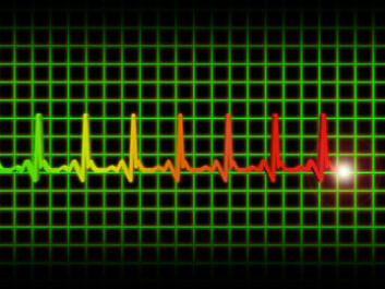 ECG with QT intervals: (Photo: Colourbox) ECG with QT intervals: (Photo: Colourbox)