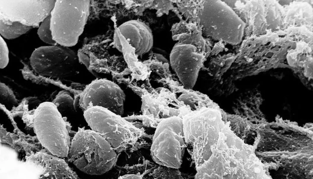 The deadly Yersinia Pestis bacterium is not particularly beautiful. But with its help, Norwegian researchers have discovered a new immune system molecule that will help us against other hazards.(Photo: Wikimedia Commons)