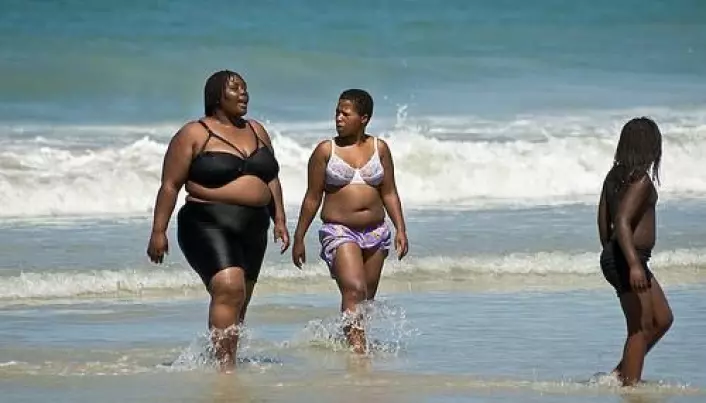 Third-world obesity linked to foetal underweight