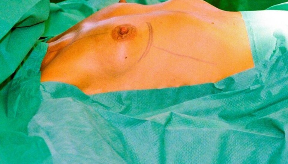 Women in the study were most eager to change their breasts and body fat. (Photo: Colourbox)