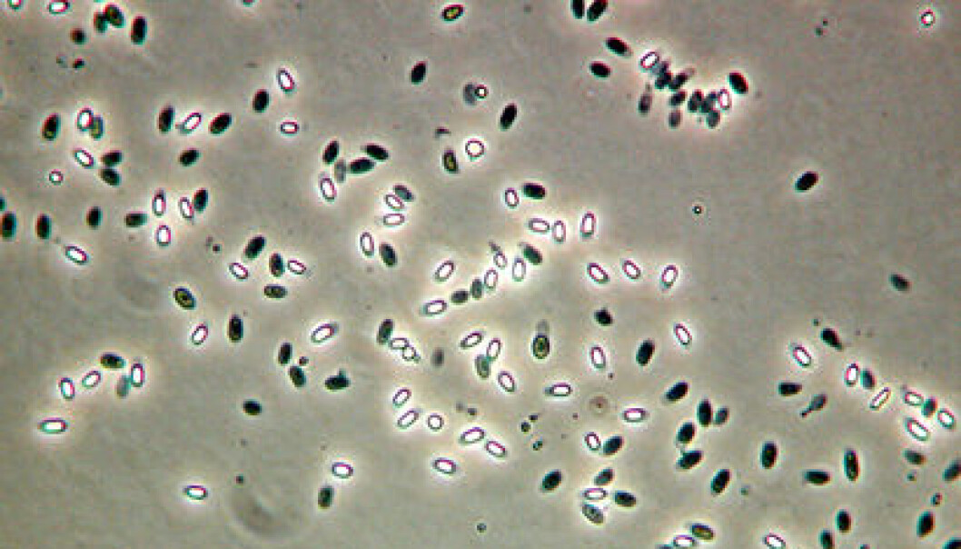 Spores of Bacillus cereus. (Photo: Thomas Rosnes, Nofima) Spores of Bacillus cereus. (Photo: Thomas Rosnes, Nofima)