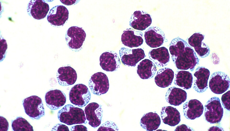 Natural killer cells (NK cells) can be part of the solution for dangerous side effects arising from stem cell transplantation.( Photo: Bent Rolstad)