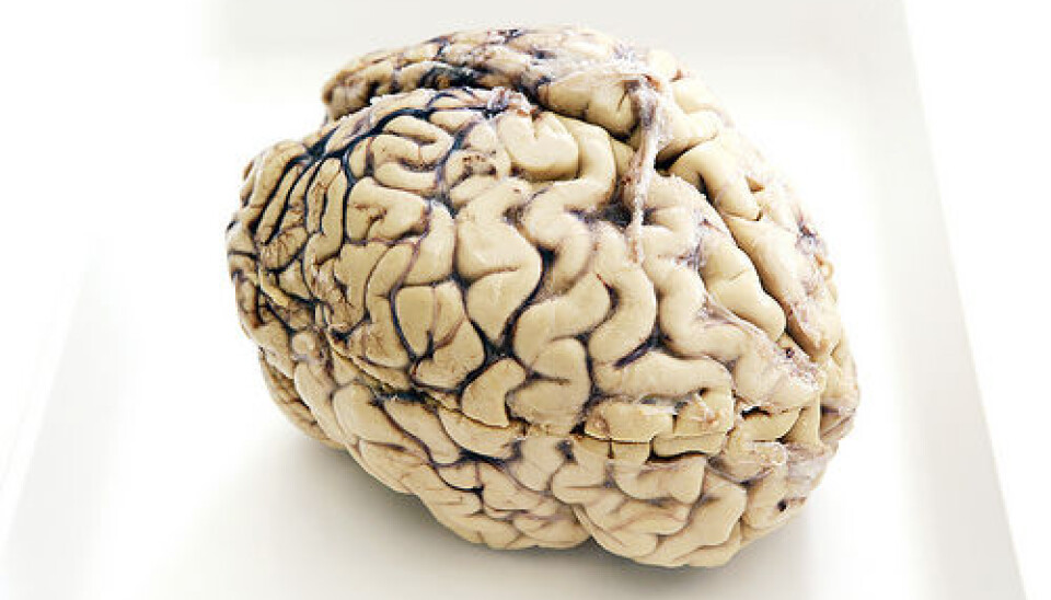 Researchers are able to show that a part of the brain that does not directly respond to sensory input, called the association cortex, is organized into modules. (Photo: Colourbox)