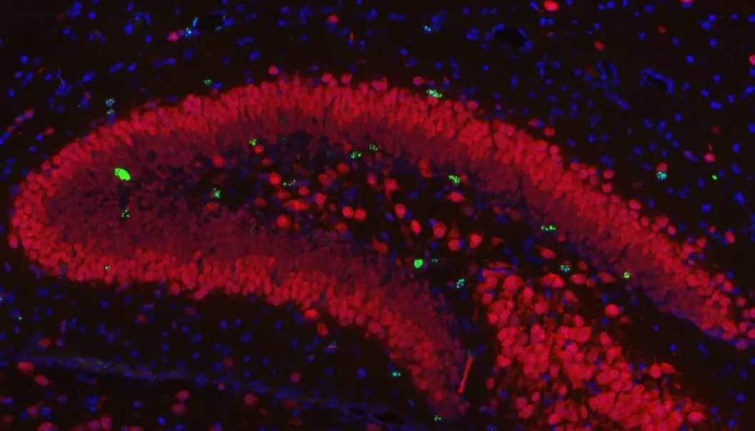A view of brain cells regenerating, in this case in the hippocampus. Cell division is a prerequisite to our memory and learning new things. The green dots show actual cell division and the red dots are neural cells. (Photo: Yngve Sejersted, OUS)