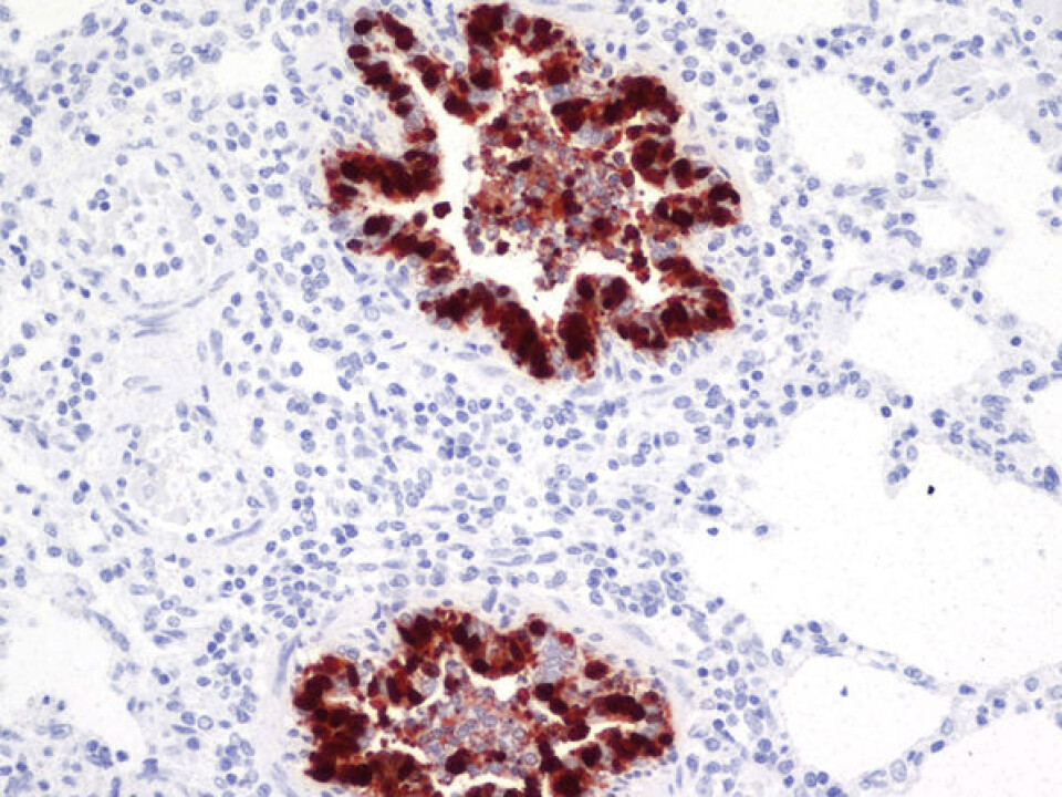Lung tissue from pig attacked by influenza A (H1N1) 2009. Infected areas are dark. (Photo: Mette Valheim)