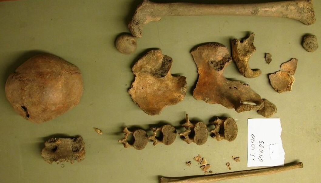 The skeletal remains of a teenager. The skull is on the left and a femur is at the top of the photo. Below this thigh bone are fragments of the pelvis, four vertebrae and at the bottom a lower leg bone, a fibula. The skeleton is from St Mary’s Church in Bergen. (Photo: Stian Hamre) The skeletal remains of a teenager. The skull is on the left and a femur is at the top of the photo. Below this thigh bone are fragments of the pelvis, four vertebrae and at the bottom a lower leg bone, a fibula. The skeleton is from St Mary’s Church in Bergen. (Photo: Stian Hamre)