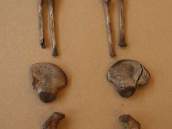 The remains of a small child. At the top is a humerus, an ulna, fragments of a pelvis, and a femur at the bottom. This skeleton was found during construction of a new Central Library in Trondheim. (Photo: Stian Hamre) The remains of a small child. At the top is a humerus, an ulna, fragments of a pelvis, and a femur at the bottom. This skeleton was found during construction of a new Central Library in Trondheim. (Photo: Stian Hamre)