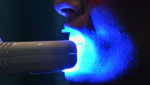 Light Is Not A Bright Idea In Teeth Bleaching