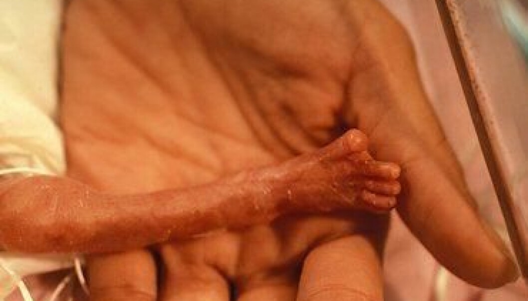 There is a higher frequency of blood poisoning among premature infants who receive a lot of nutrition to ensure that they grow. (Illustration photo: Colourbox) There is a higher frequency of blood poisoning among premature infants who receive a lot of nutrition to ensure that they grow. (Illustration photo: Colourbox)