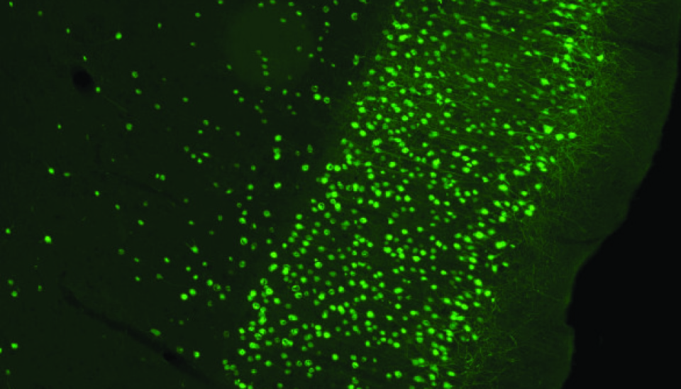 Section of rat brain. The image shows cells in the entorhinal cortex that have been infected by a virus injected into the hippocampus. The virus carrying the gene for a green fluorescent dye makes it possible to view the infected cells. (Photo: Kavli Institute)