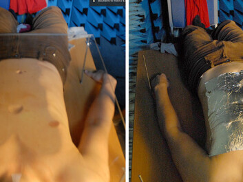 Øyvind Aardal used himself as a human guinea pig to test different hypotheses of how radar was able to detect the beating of a heart. Left: A Plexiglas plate is supposed to block all minor movements of the skin. Right: Metal foil stops the beamed radar from entering the body. (Photo: Øyvind Aardal, FFI)
Øyvind Aardal used himself as a human guinea pig to test different hypotheses of how radar was able to detect the beating of a heart. Left: A Plexiglas plate is supposed to block all minor movements of the skin. Right: Metal foil stops the beamed radar from entering the body. (Photo: Øyvind Aardal, FFI)