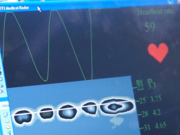 Radar detects a pulse via tiny skin movements made by each heartbeat. (Photo: Arnfinn Christensen, forskning.no) Radar detects a pulse via tiny skin movements made by each heartbeat. (Photo: Arnfinn Christensen, forskning.no)