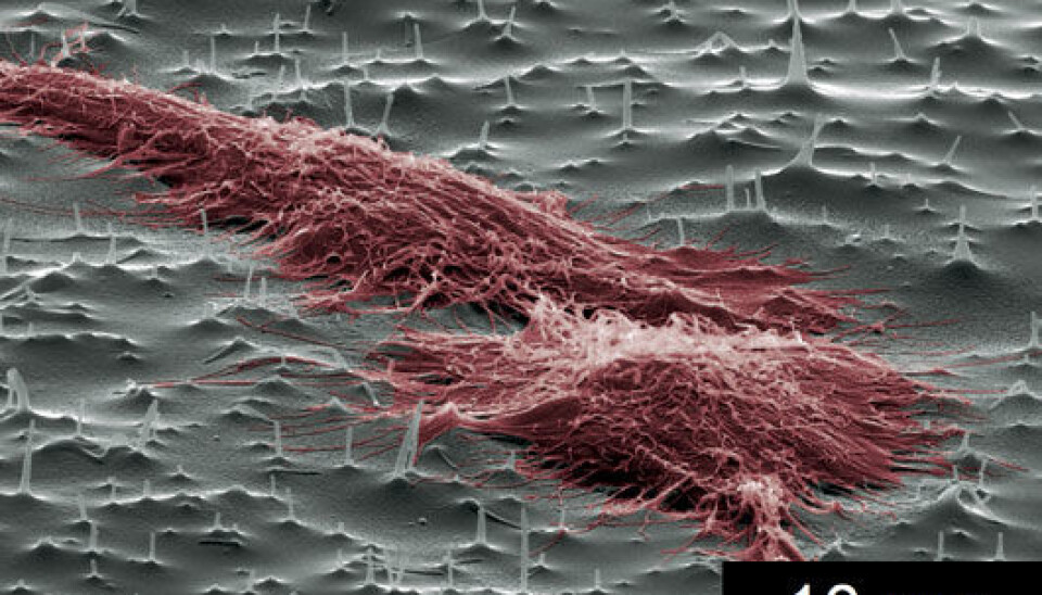 Into the oven goes a thin copper plate. Out come the needles that will force stubborn cells to take their medicine. (Photo: NTNU)