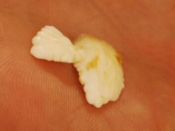 Remnants of blood and other tissue can be found on otoliths, seen here as yellow-brown residue, containing DNA. (Photo: Hanne Østli Jakobsen) Remnants of blood and other tissue can be found on otoliths, seen here as yellow-brown residue, containing DNA. (Photo: Hanne Østli Jakobsen)