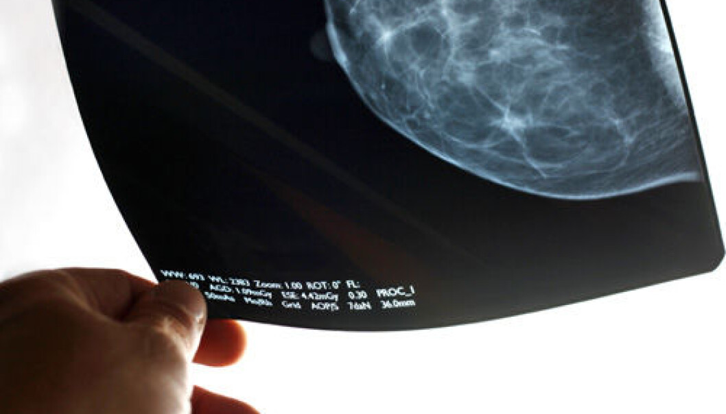 Medical researchers are in disagreement about the effect of extensive mammograms to screen for breast cancer. (Photo: iStockphoto) Medical researchers are in disagreement about the effect of extensive mammograms to screen for breast cancer. (Photo: iStockphoto)