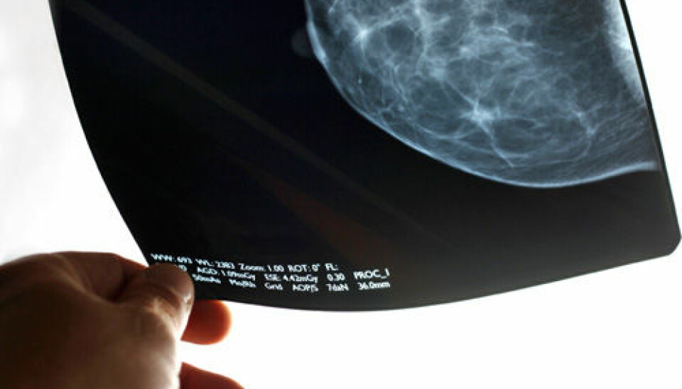 Medical researchers are in disagreement about the effect of extensive mammograms to screen for breast cancer. (Photo: iStockphoto)