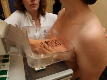 All women 50 to 69 in Norway are offered mammograms to spot potential breast cancers. (Photo: Colourbox) All women 50 to 69 in Norway are offered mammograms to spot potential breast cancers. (Photo: Colourbox)