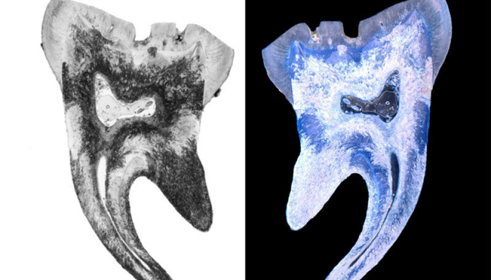 An ancient human tooth cut in two. The black flecks in the left-hand image show that it has been broken down by bacteria. Photo: Hege Ingjerd Hollund