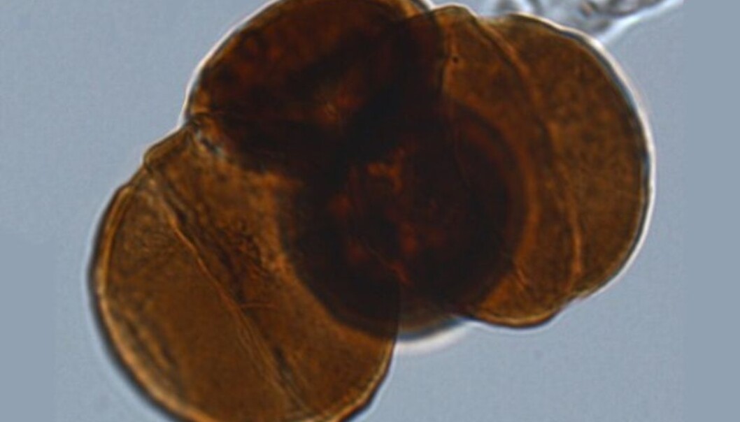 Mutated grains of pollen from a conifer that lived 200 million year ago. (Photo: Wofram M. Küschner, University of Oslo) Mutated grains of pollen from a conifer that lived 200 million year ago. (Photo: Wofram M. Küschner, University of Oslo)