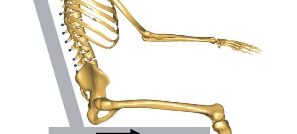 Computer model mimics mechanism behind pressure ulcers