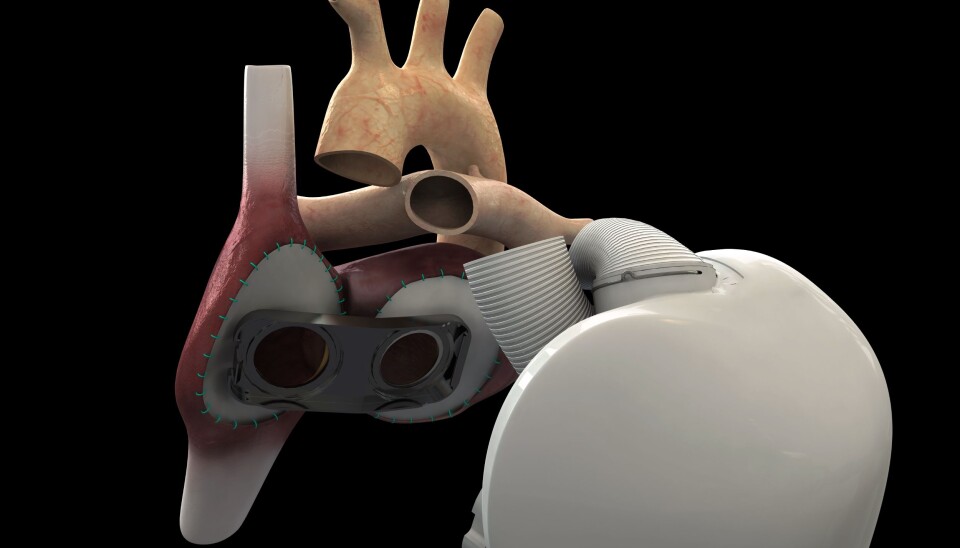 Schematic figure of the heart, showing the main blood vessels. The 'holes' indicate the two main cardiac arteries. (Illustration: Carmat)