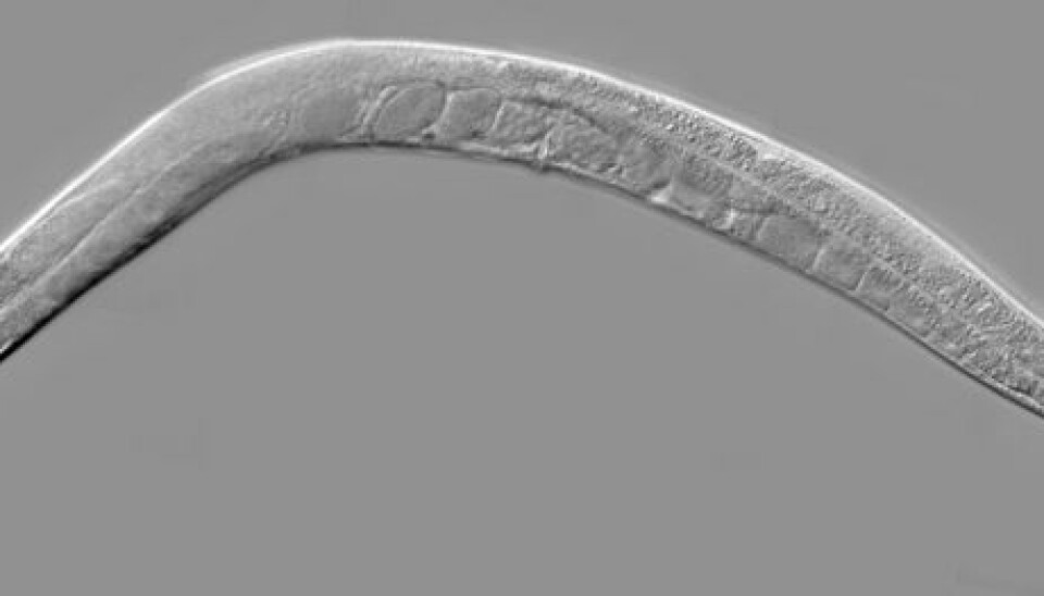 Nematodes are microscopic creatures that can adapt to the toughest environments. The photo shows the nematode C. elegans as seen through a microscope. (Photo: Wikimedia Commons)