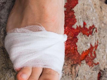 Legs and feet suffer most. (Photo: Colourbox) Legs and feet suffer most. (Photo: Colourbox)