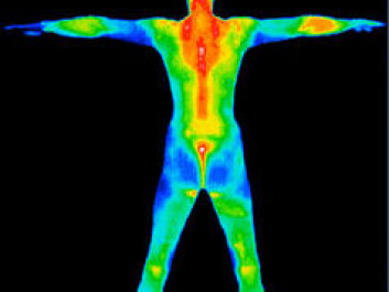 Skin temperatures can vary, but the differences mustn’t be too great if we want to stay comfortable. (Photo: Wikimedia Commons) Skin temperatures can vary, but the differences mustn’t be too great if we want to stay comfortable. (Photo: Wikimedia Commons)