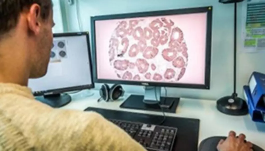Medical researchers studying sections of colon cancer tumours, looking for signs of relapse. (Photo: Jarle Bruun)