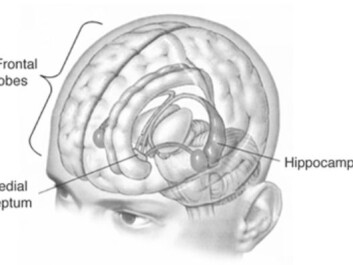 In an attempt to cure his severe and debilitating epilepsy, H.M.’s surgeons removed vital parts of his brain, including the hippocampus. (Illustration: Wikimedia Commons) In an attempt to cure his severe and debilitating epilepsy, H.M.’s surgeons removed vital parts of his brain, including the hippocampus. (Illustration: Wikimedia Commons)