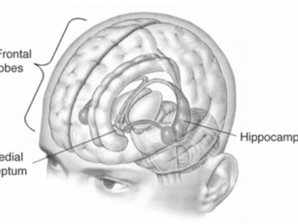 In an attempt to cure his severe and debilitating epilepsy, H.M.’s surgeons removed vital parts of his brain, including the hippocampus. (Illustration: Wikimedia Commons)
