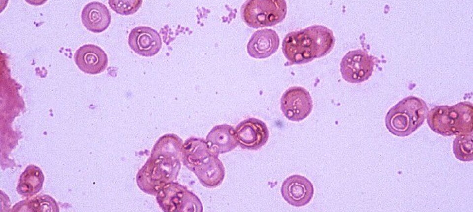 Cunning respiratory bacteria help each other survive