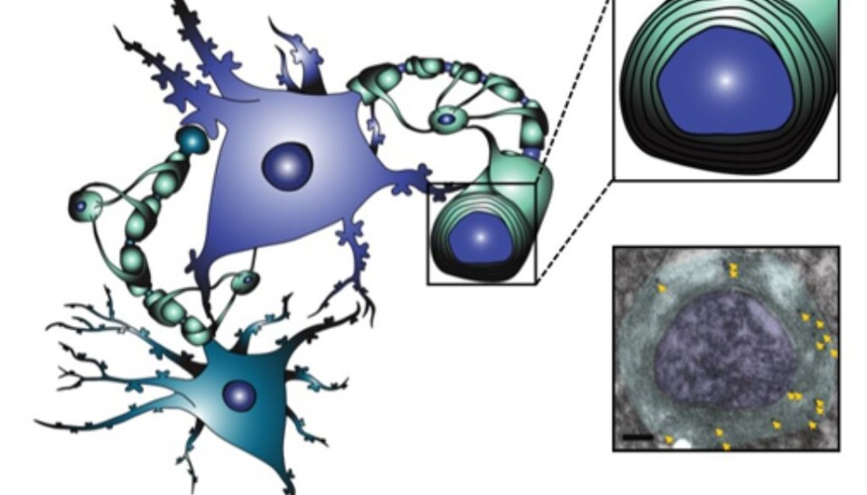 A bluegreen nerve cell contacting a blue nerve cell. In the upper right image, the insulation material is coloured green. The lower right image is taken from the electron microscope. The arrows point at dots representing NAA in the isolation material. (Illustration: Kaja Nordengen)
