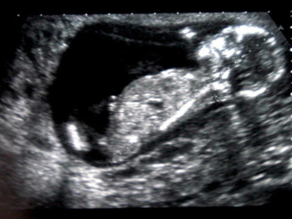 The diseases start in utero. (Photo: Colourbox)