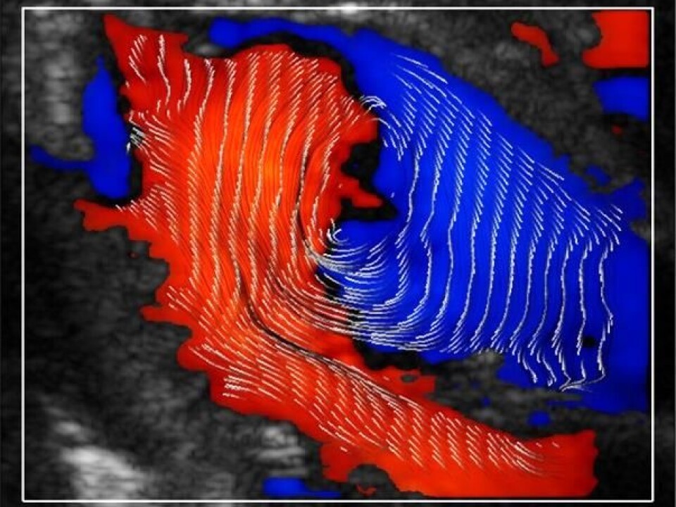 The pattern and direction of blood flow in the heart is very clearly visible with the new technology. (Photo: NTNU)