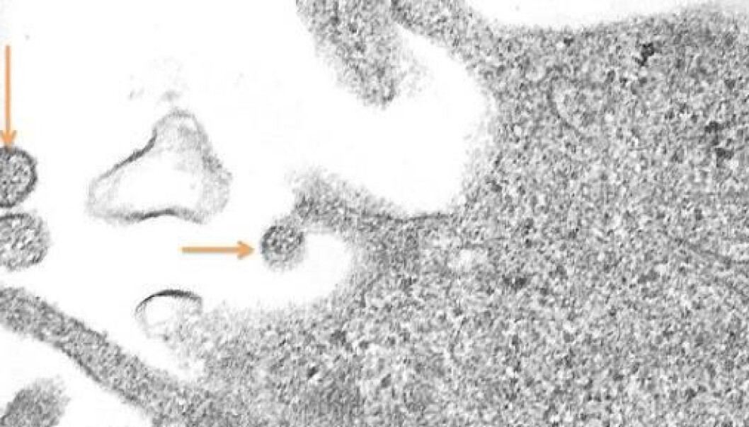 The human metapneumovirus (hMPV) under a microscope. The virus is spreading from an infected cell. (EM photo: Are Dalen) The human metapneumovirus (hMPV) under a microscope. The virus is spreading from an infected cell. (EM photo: Are Dalen)