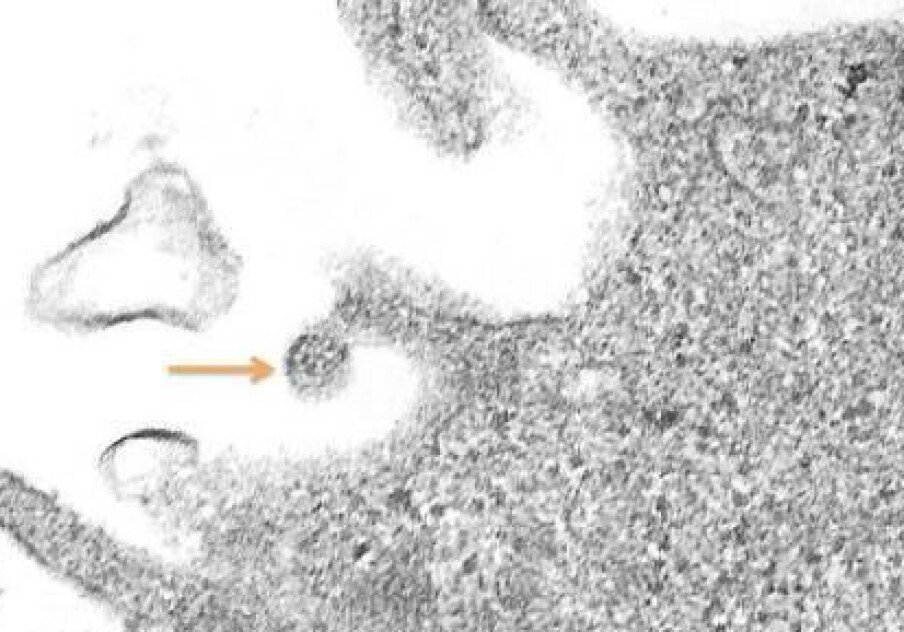 Microbes Pacman Tag: microbiology
