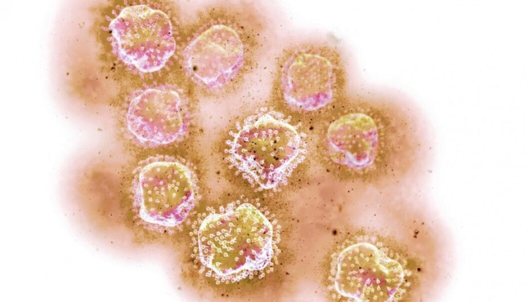 An artistic rendering of the hepatitis C virus. The virus attacks liver cells, causing severe damage, or even death. (Illustration: Science Photo Library) An artistic rendering of the hepatitis C virus. The virus attacks liver cells, causing severe damage, or even death. (Illustration: Science Photo Library)