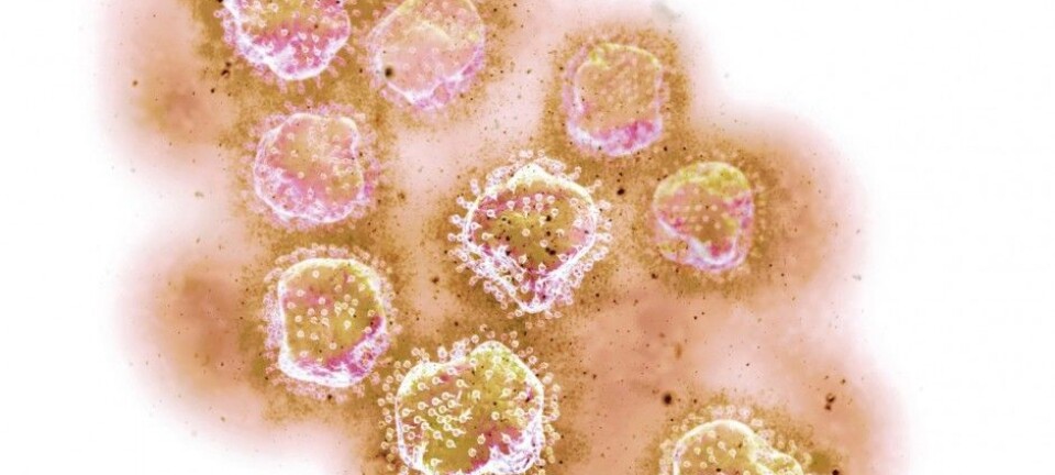 Genetic variant protects against hepatitis C