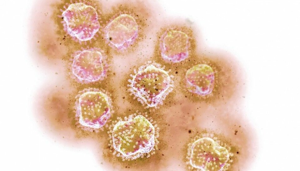 An artistic rendering of the hepatitis C virus. The virus attacks liver cells, causing severe damage, or even death. (Illustration: Science Photo Library)