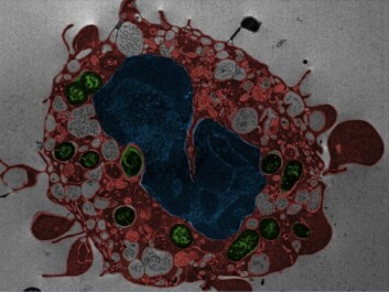 An immune-system cell dies from Yersinia pestis infection. The cell membrane blisters and the cell’s nucleus mutates. Green: Bacteria. Red: Cell contents. Blue: Nucleus. (Photo: Weng et al. PNAS 2014, 111:7391) An immune-system cell dies from Yersinia pestis infection. The cell membrane blisters and the cell’s nucleus mutates. Green: Bacteria. Red: Cell contents. Blue: Nucleus. (Photo: Weng et al. PNAS 2014, 111:7391)