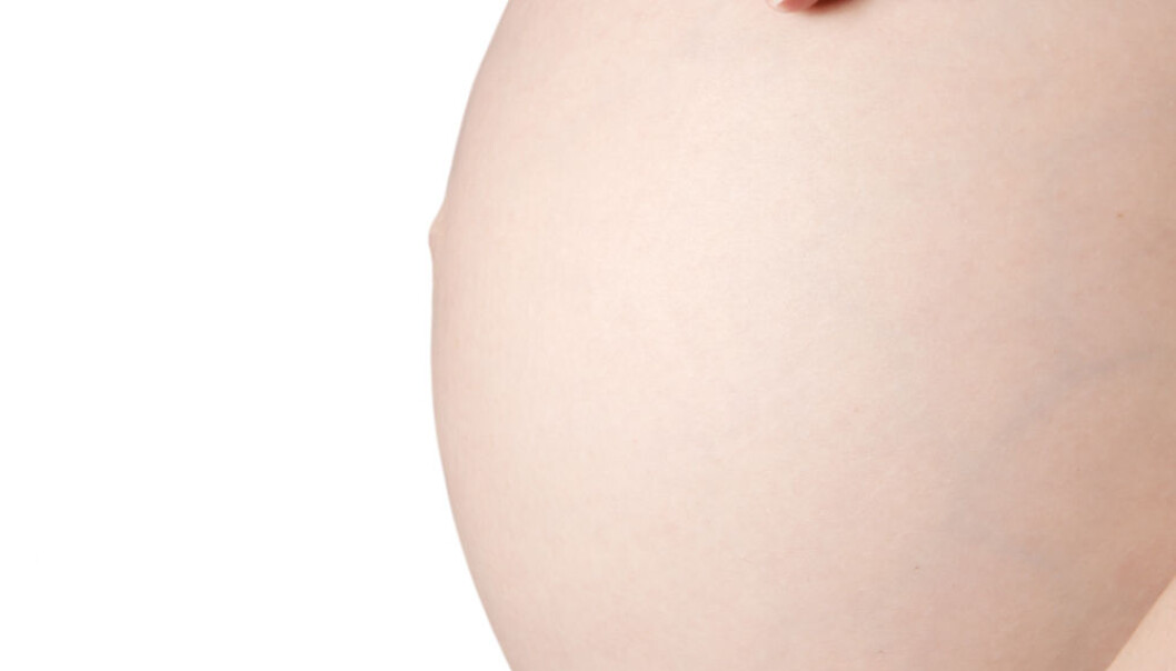 17 percent of births were by caesareans in Norway in 2009. (Photo: Colourbox) 17 percent of births were by caesareans in Norway in 2009. (Photo: Colourbox)