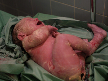 In Norway no woman can simply demand a c-section and get it but women’s requests are taken into concideration by the medical staff.(Photo: Colourbox) In Norway no woman can simply demand a c-section and get it but women’s requests are taken into concideration by the medical staff.(Photo: Colourbox)