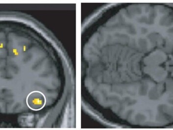 Two regions of the brain were activated in the experiment: the anterior part of the temporal lobe and the lower part of the frontal lobe. These are areas that are already known for connecting different senses. Here, the frontal lobe is shown. (Photo: Jonas Olofsson / Stockholm University) Two regions of the brain were activated in the experiment: the anterior part of the temporal lobe and the lower part of the frontal lobe. These are areas that are already known for connecting different senses. Here, the frontal lobe is shown. (Photo: Jonas Olofsson / Stockholm University)