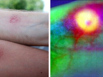 Bruises from being struck. A hyperspectral image taken in an experiment with a paintball leaves no doubt about an injury. (Photos: Lise Randeberg, NTNU) Bruises from being struck. A hyperspectral image taken in an experiment with a paintball leaves no doubt about an injury. (Photos: Lise Randeberg, NTNU)