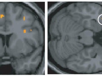 The temporal lobe. (Photo: Jonas Olofsson / Stockholm University)
The temporal lobe. (Photo: Jonas Olofsson / Stockholm University)